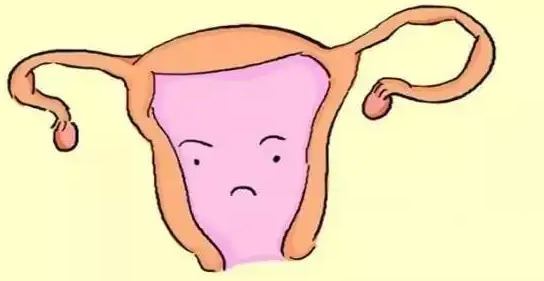 幼稚子宫
