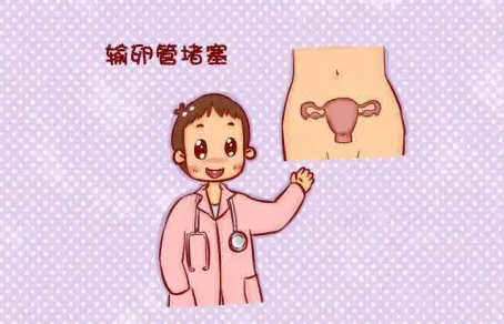 输卵管堵塞