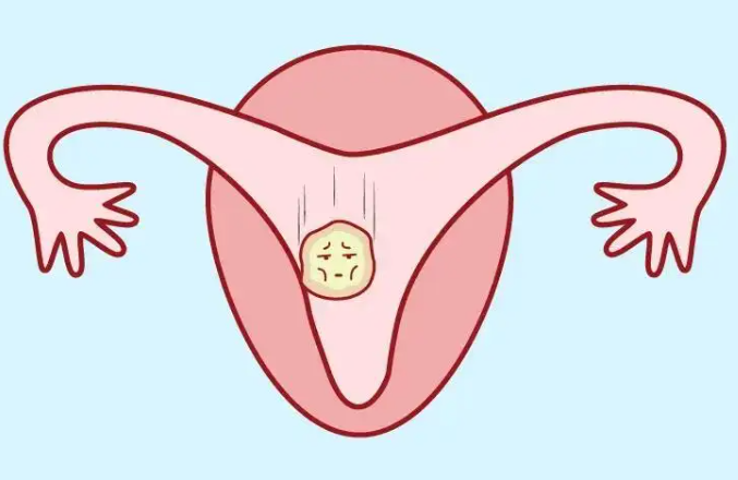 宫内膜薄会不会影响怀孕
